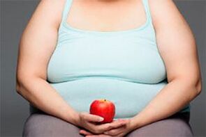 A varikózus vénák gyógyításához le kell fogynia a túlsúlyról